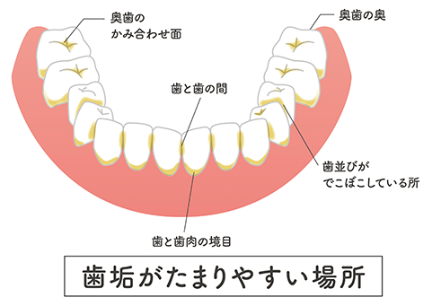 歯垢がたまりやすい場所を意識して効率的に歯みがきをしましょう